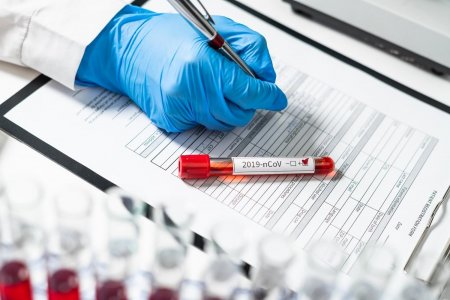 Azərbaycanda daha 352 nəfər koronavirusa yoluxub - 6 nəfər ölüb