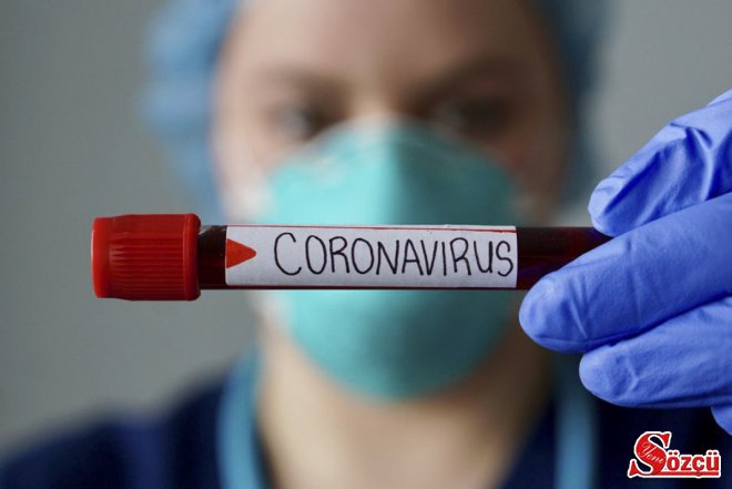 Rusiyada koronavirusdan ölənlərin sayı 165 mini keçib
