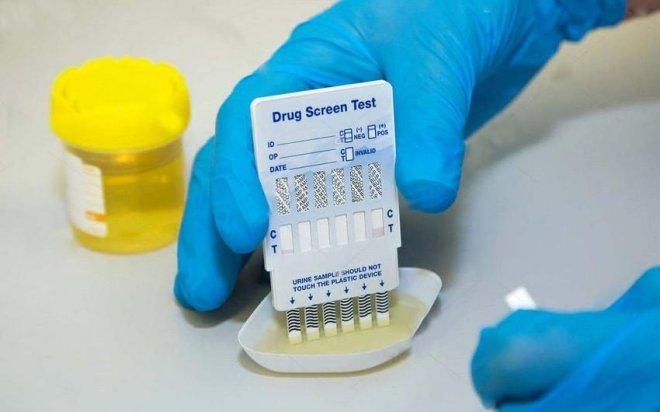 "Dövlət qurumlarında narkotikə qurşanan şəxslər var" - Deputat