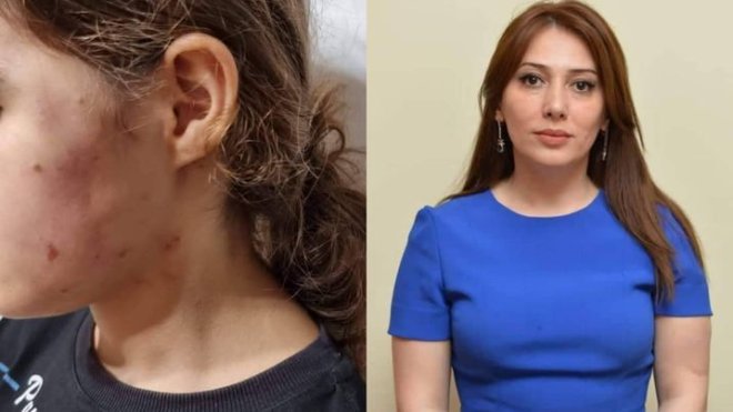 Bilirsiniz, o, bizə necə qan uddurub?" -