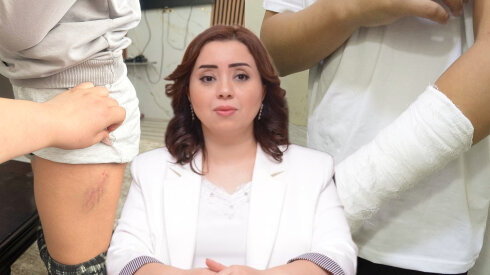 Bu məktəbdə xəsarətlə nəticələnən münaqişə valideyndən GİZLƏDİLDİ -