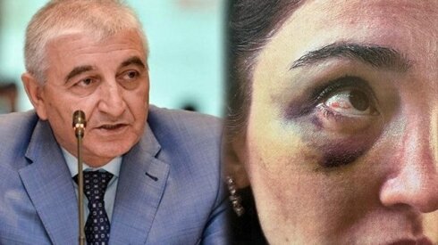 Məzahir Pənahovun keçmiş gəlininin acı hekayəsi -