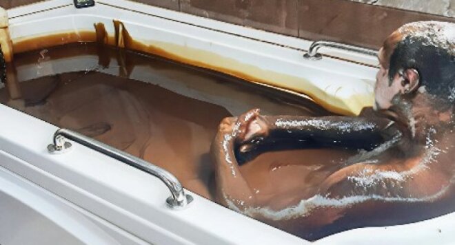 Azərbaycanda kişi sanatoriyada öldü