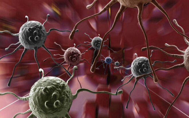 Zərərsiz bildiyimiz vərdişlər xərçəngə aparır -